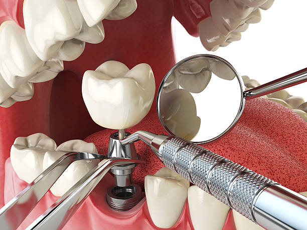 Best Tooth Pain Emergency Relief  in Harbor Hills, OH